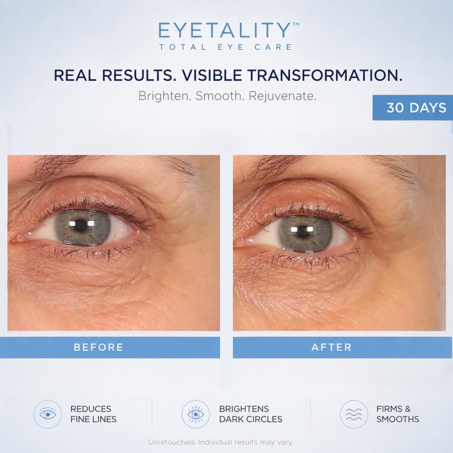 Serious Skincare Eyetality AM daytime eye treatment with cooling de-puffing applicator wand, caffeine and peptides to brighten, refresh and smooth tired-looking eyes.