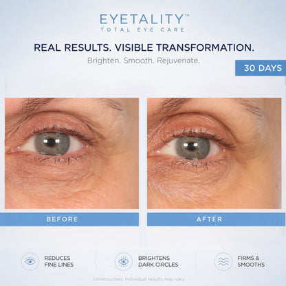 Serious Skincare Eyetality AM daytime eye treatment with cooling de-puffing applicator wand, caffeine and peptides to brighten, refresh and smooth tired-looking eyes.