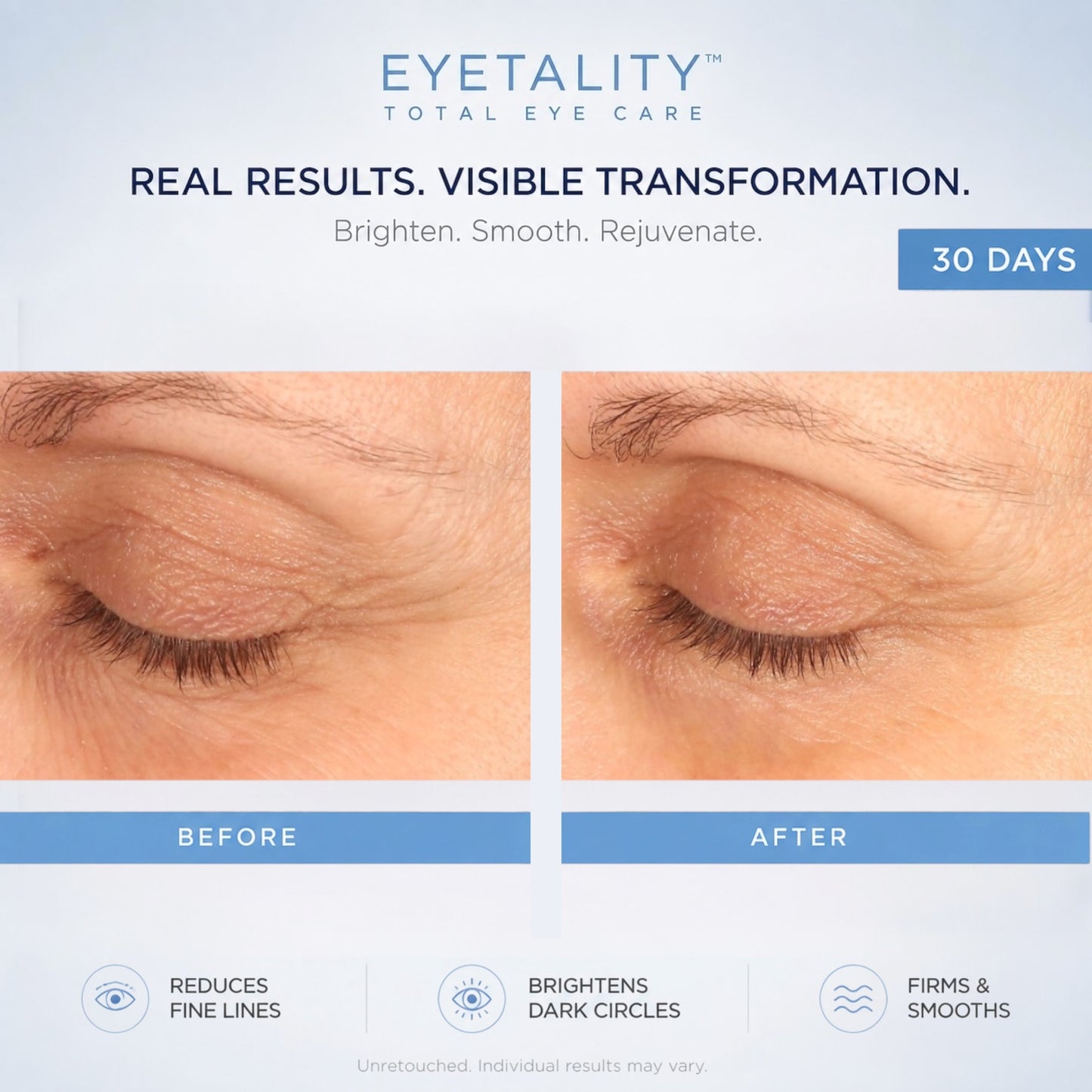 Serious Skincare Eyetality AM daytime eye treatment with cooling de-puffing applicator wand, caffeine and peptides to brighten, refresh and smooth tired-looking eyes.