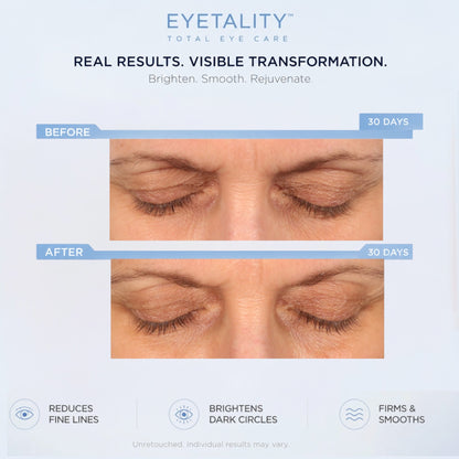 Serious Skincare Eyetality AM daytime eye treatment with cooling de-puffing applicator wand, caffeine and peptides to brighten, refresh and smooth tired-looking eyes.
