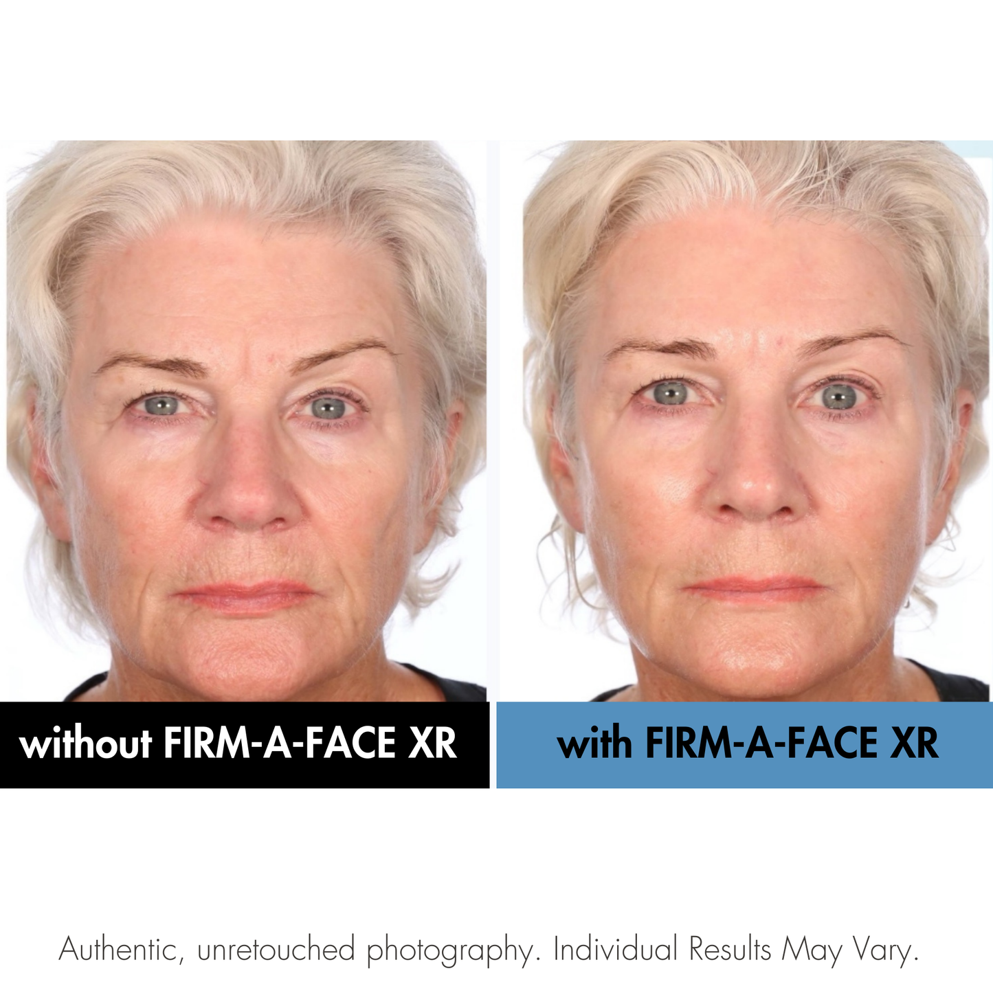 Firm A Face Before and After.  Serious Skincare.  