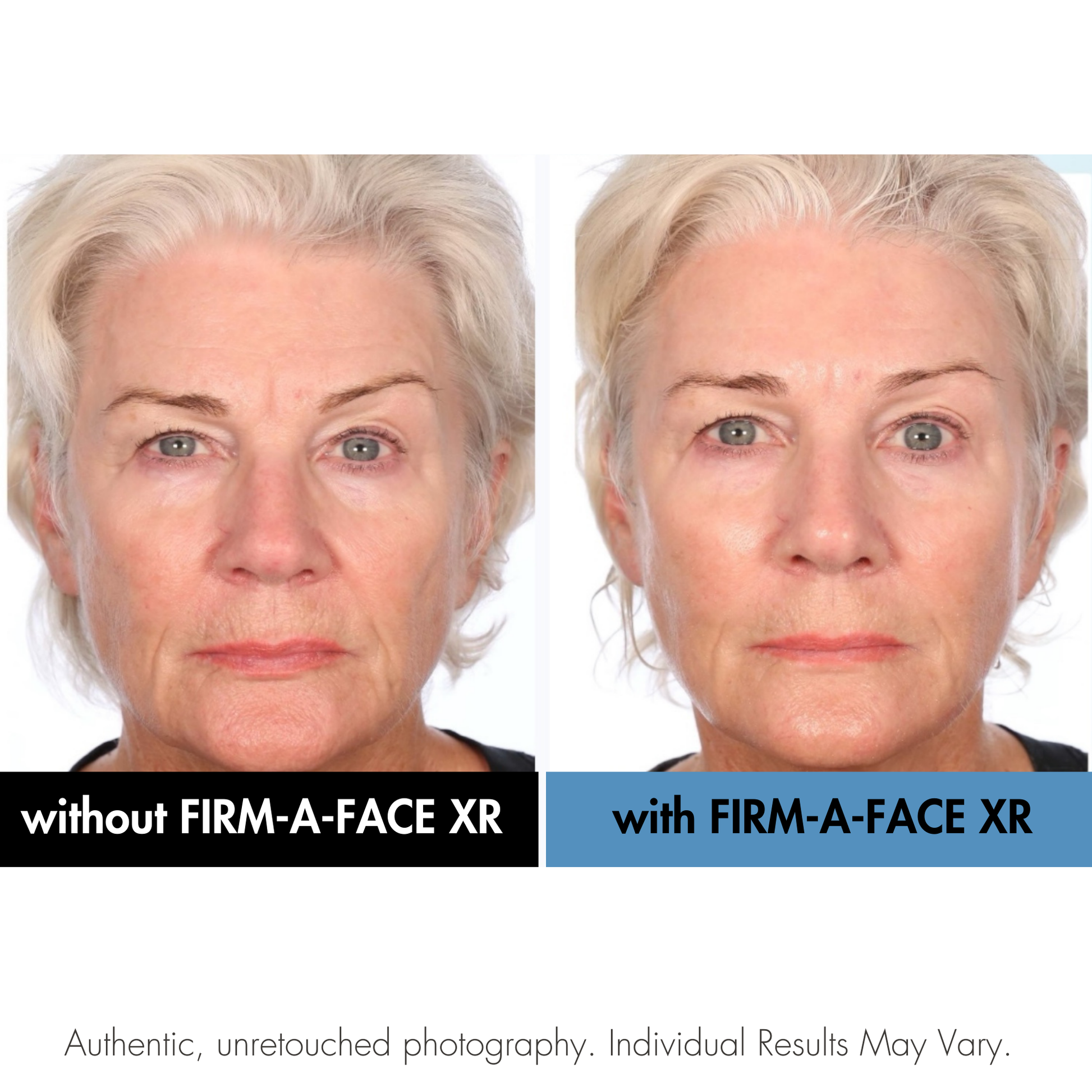Firm A Face Before and After.  Serious Skincare.  
