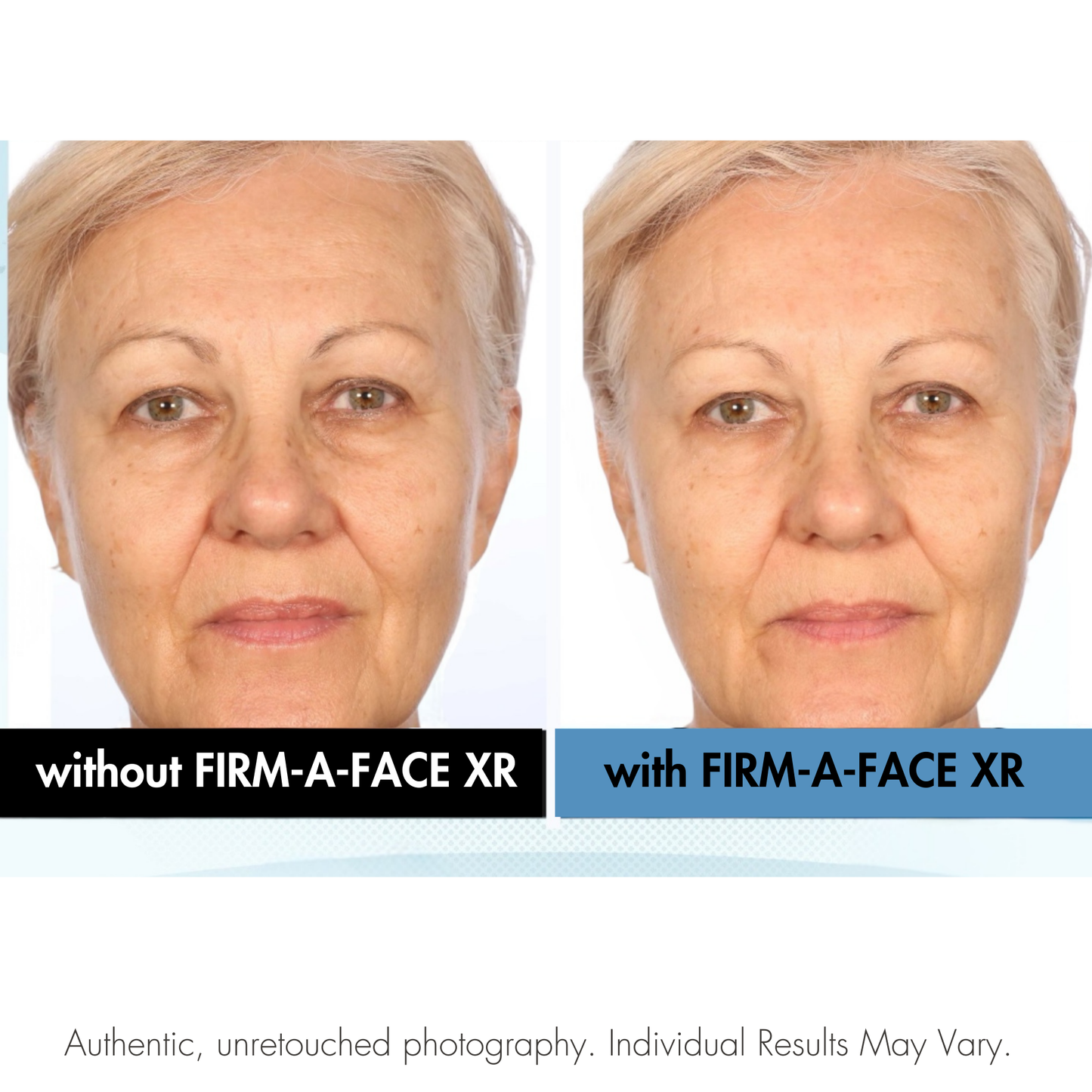 Before and after comparison of a woman's face with and without Firm-A-Face XR treatment. Serious Skincare.