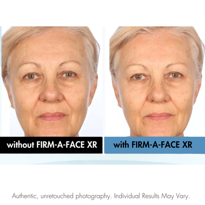 Before and after comparison of a woman's face with and without Firm-A-Face XR treatment. Serious Skincare.