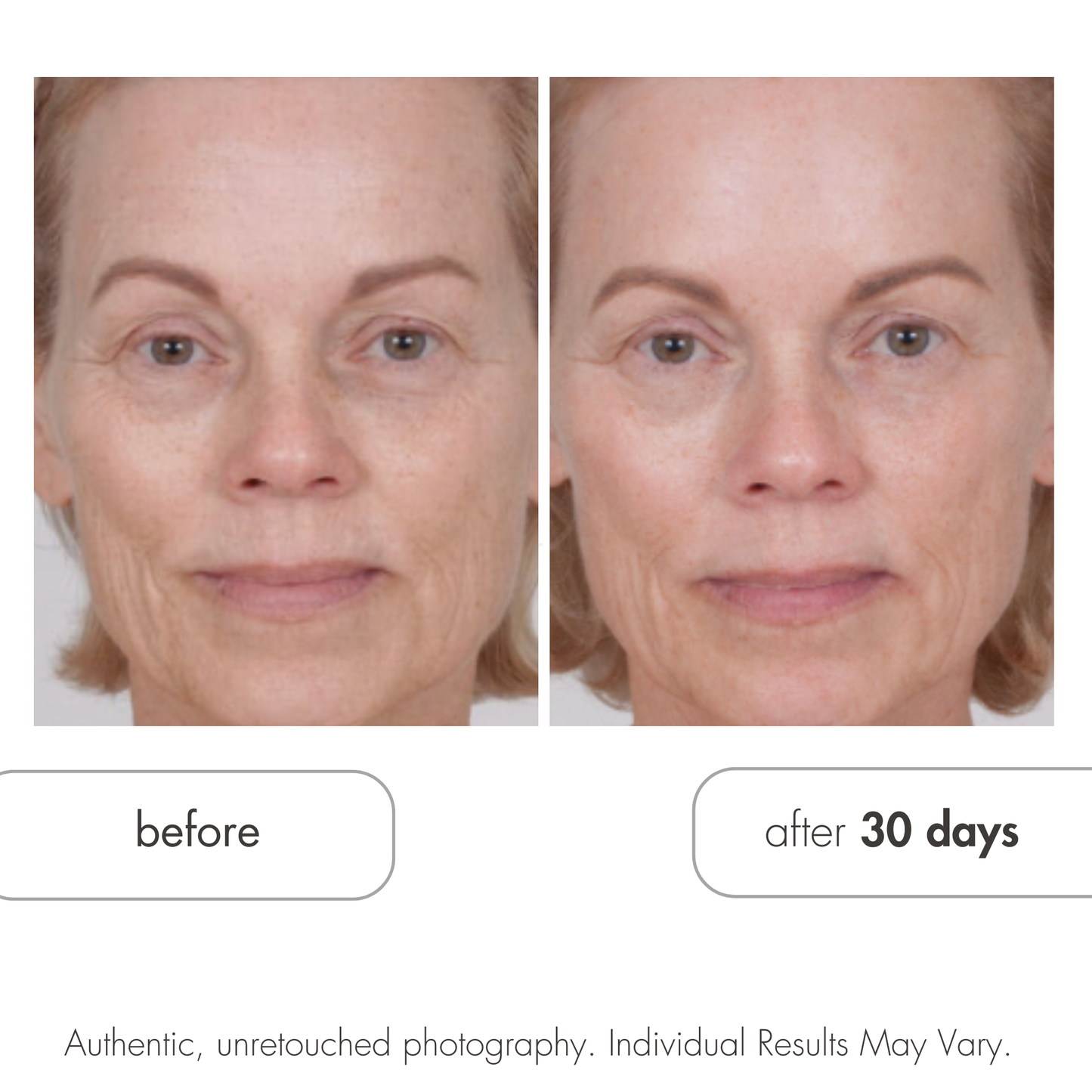 Before and after comparison of a woman's face with text indicating 'after 30 days'.  Glycolic Retexturizing by Serious Skincare