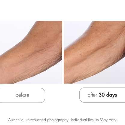 Glycolic Retexturizing Body Cream