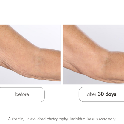 Glycolic Retexturizing Body Cream