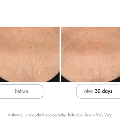 Glycolic Retexturizing Body Cream