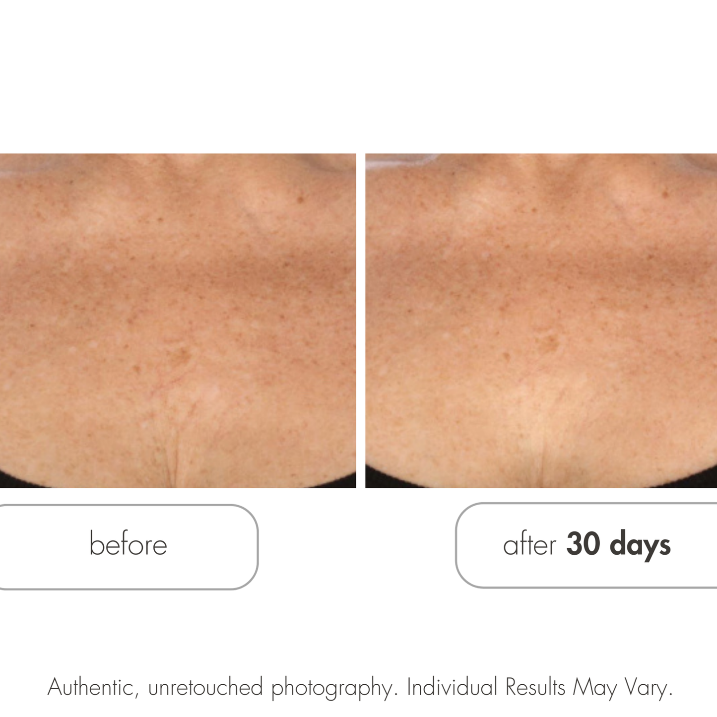 Glycolic Retexturizing Body Cream