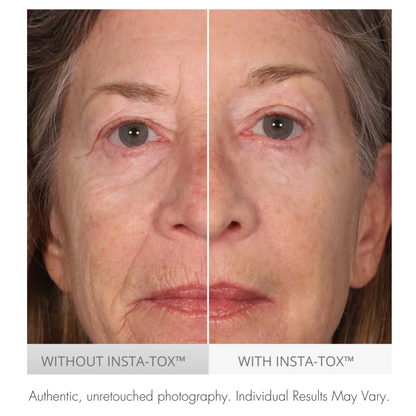 Before and after comparison of a woman's face with and without Insta-Tox treatment.