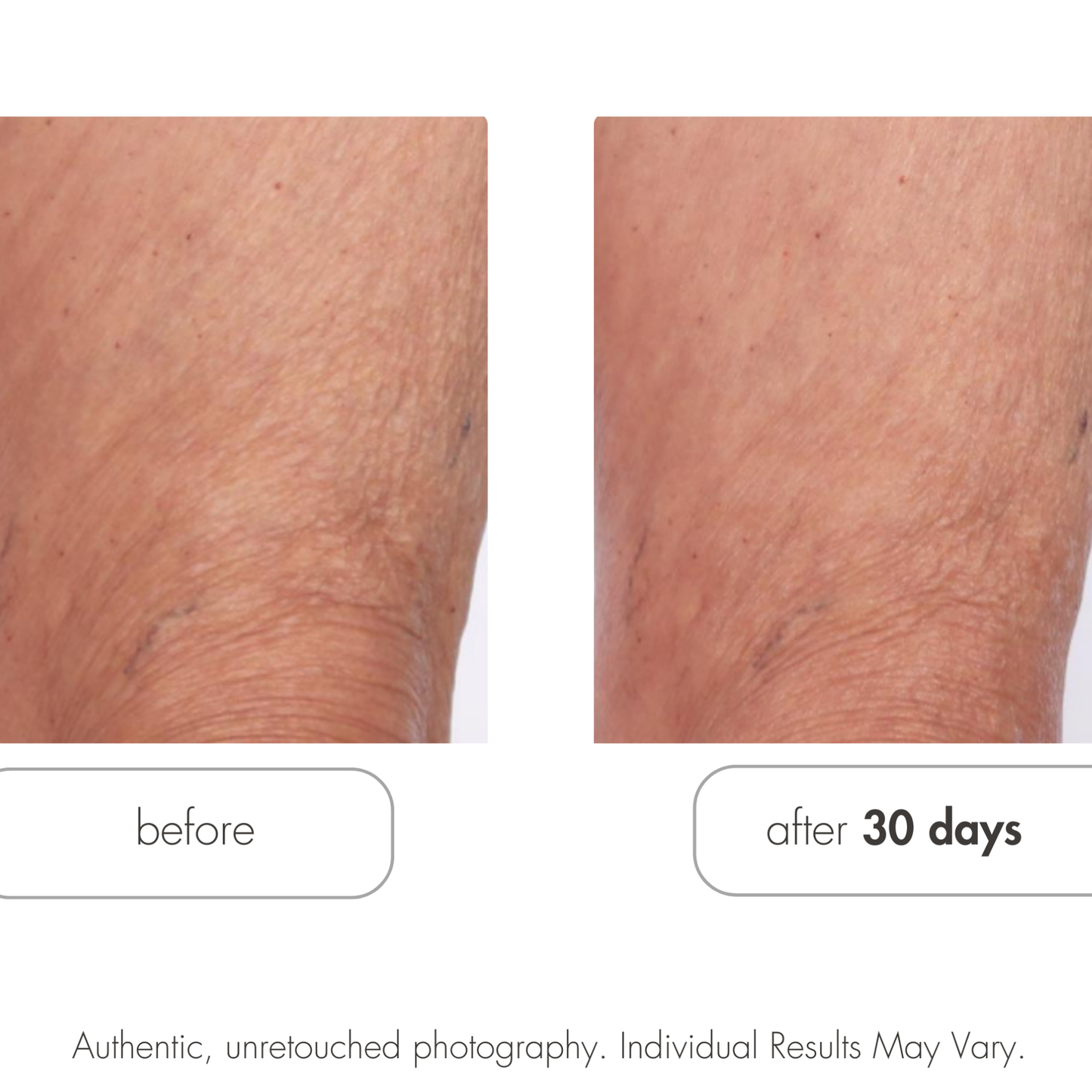 Glycolic Retexturizing Body Cream