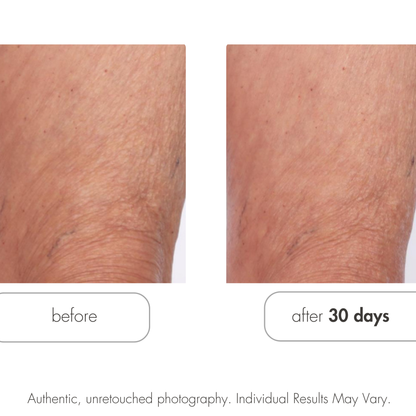 Glycolic Retexturizing Body Cream