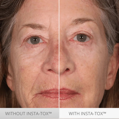 Serious Skincare.  Temporary. Targeted. Facial Firming Wrinkle Smoothing Serum.  Alternative to botox.  