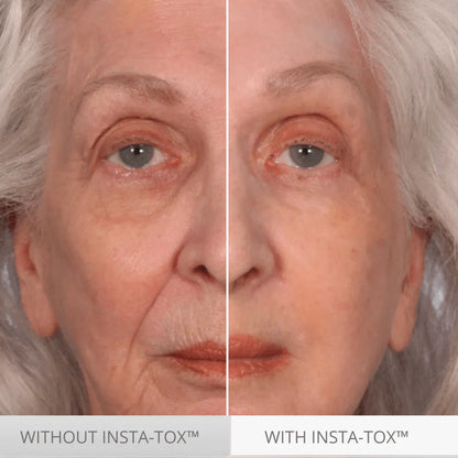 Serious Skincare.  Temporary. Targeted. Facial Firming Wrinkle Smoothing Serum.  Alternative to botox.  