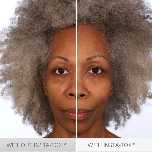 Serious Skincare.  Temporary. Targeted. Facial Firming Wrinkle Smoothing Serum.  Alternative to botox.  