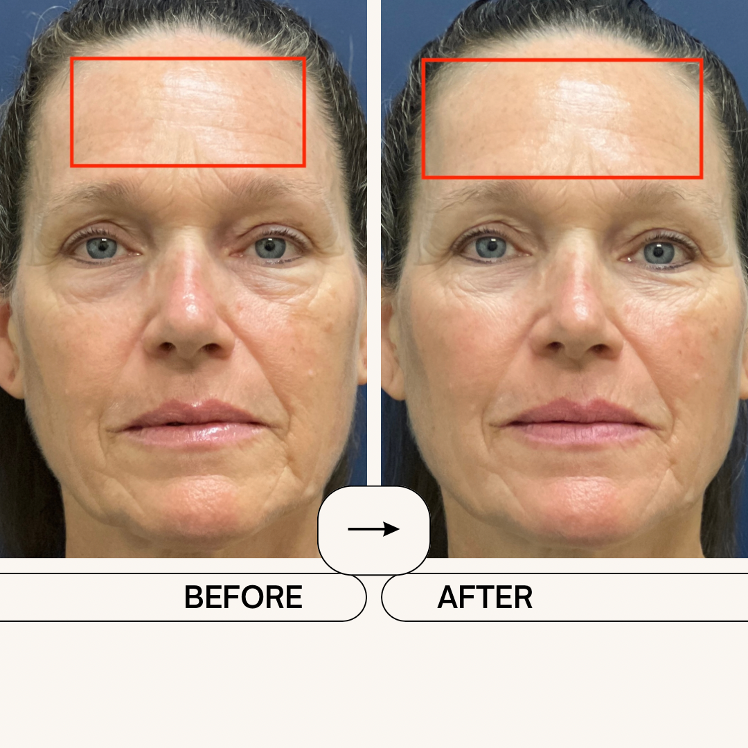 Before and after image of a serious skincare customer