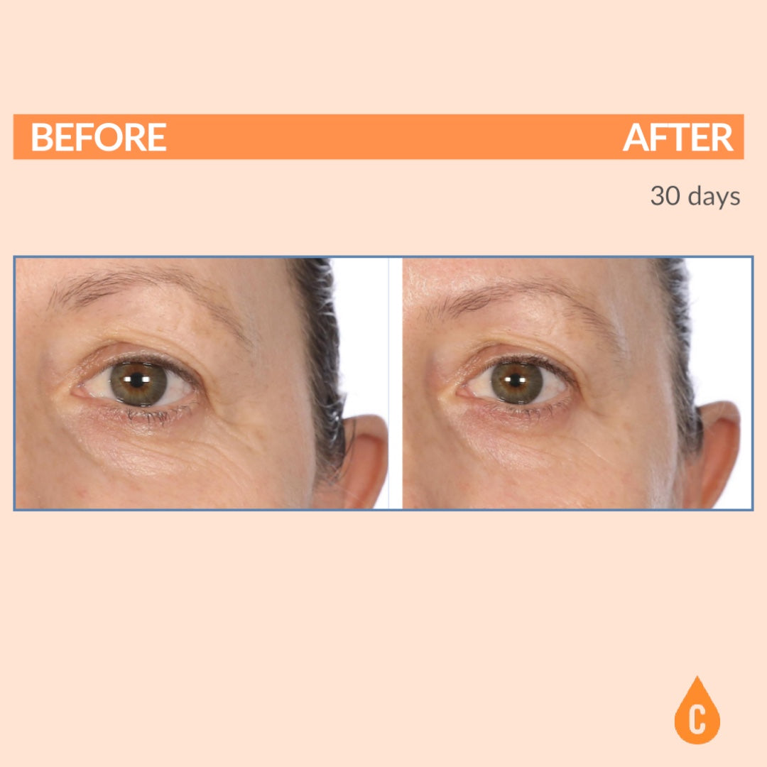 Vitamin c eye top skin care