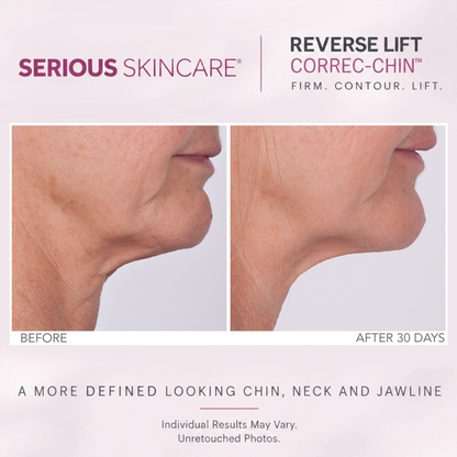 Reverse Lift Correc-Chin