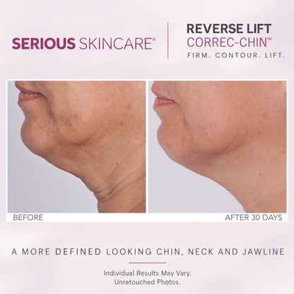 Reverse Lift Correc-Chin