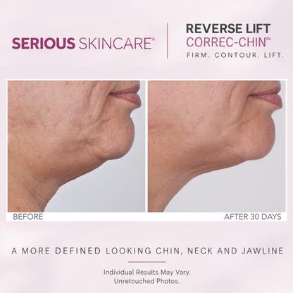 Reverse Lift Correc-Chin