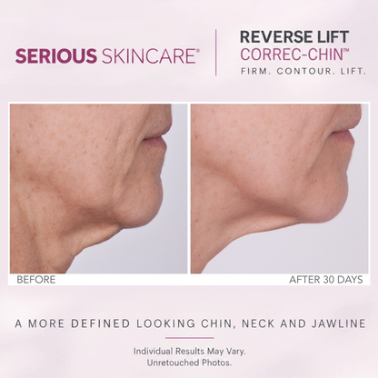 Reverse Lift Correc-Chin