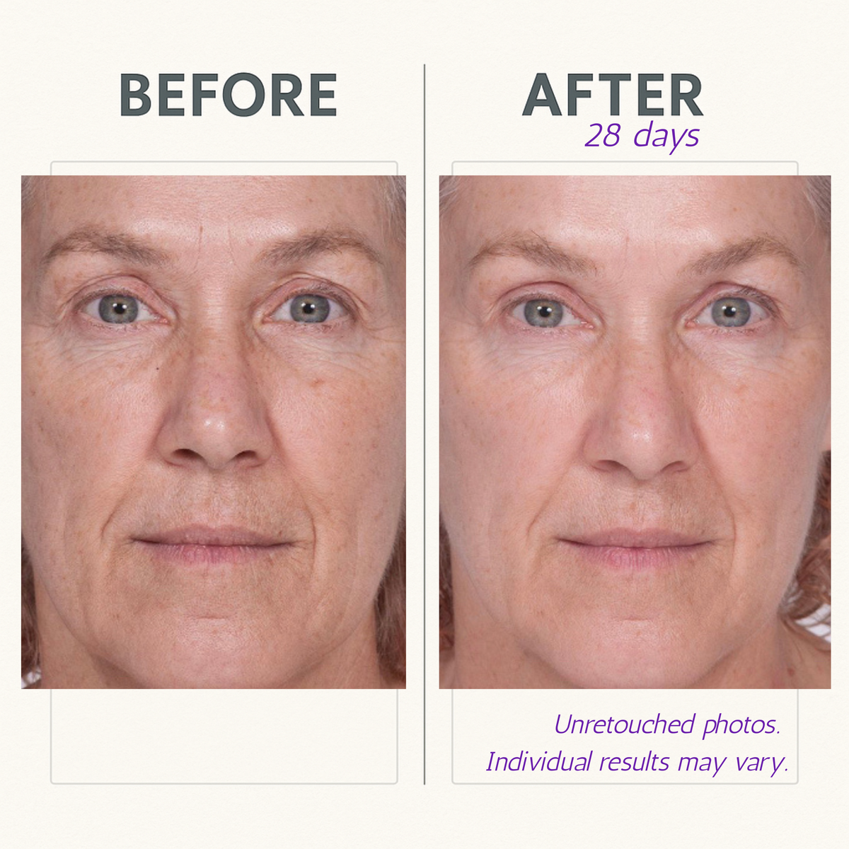 Serious Skincare Reverse Lift with ARGIFIRM Reverse Serum Firming Facial Serum to smooth fine lines and wrinkles, blur pores, and visibly firm and tighten skin.