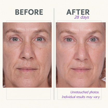 Serious Skincare Reverse Lift with ARGIFIRM Reverse Serum Firming Facial Serum to smooth fine lines and wrinkles, blur pores, and visibly firm and tighten skin.