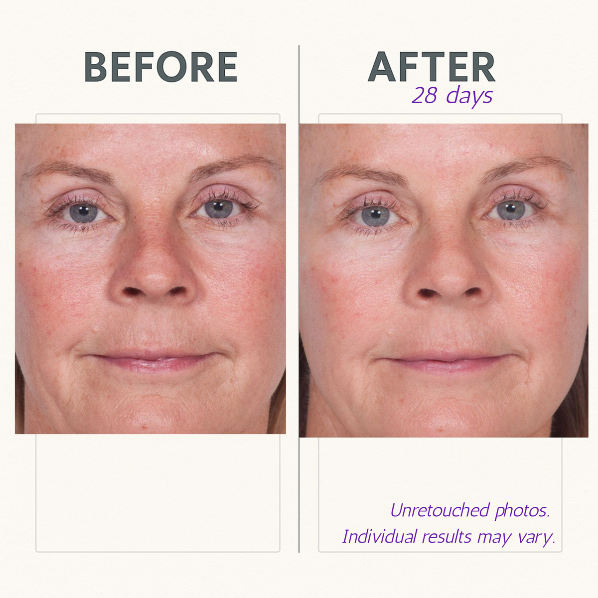 Serious Skincare Reverse Lift with ARGIFIRM Reverse Serum Firming Facial Serum to smooth fine lines and wrinkles, blur pores, and visibly firm and tighten skin.