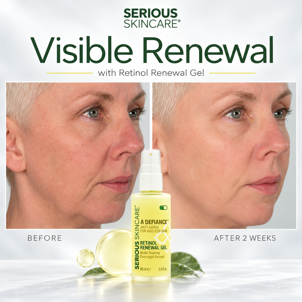 Serious Skincare's Retinol Renewal Gel is a lightweight, retinol-rich gel is specially formulated to complement skin’s natural nighttime renewal process, working while you sleep to help improve the appearance of fine lines, uneven texture, dullness and visible signs of aging.