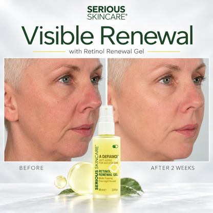 Serious Skincare's Retinol Renewal Gel is a lightweight, retinol-rich gel is specially formulated to complement skin’s natural nighttime renewal process, working while you sleep to help improve the appearance of fine lines, uneven texture, dullness and visible signs of aging.