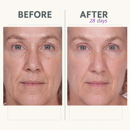 Reverse Lift Serum