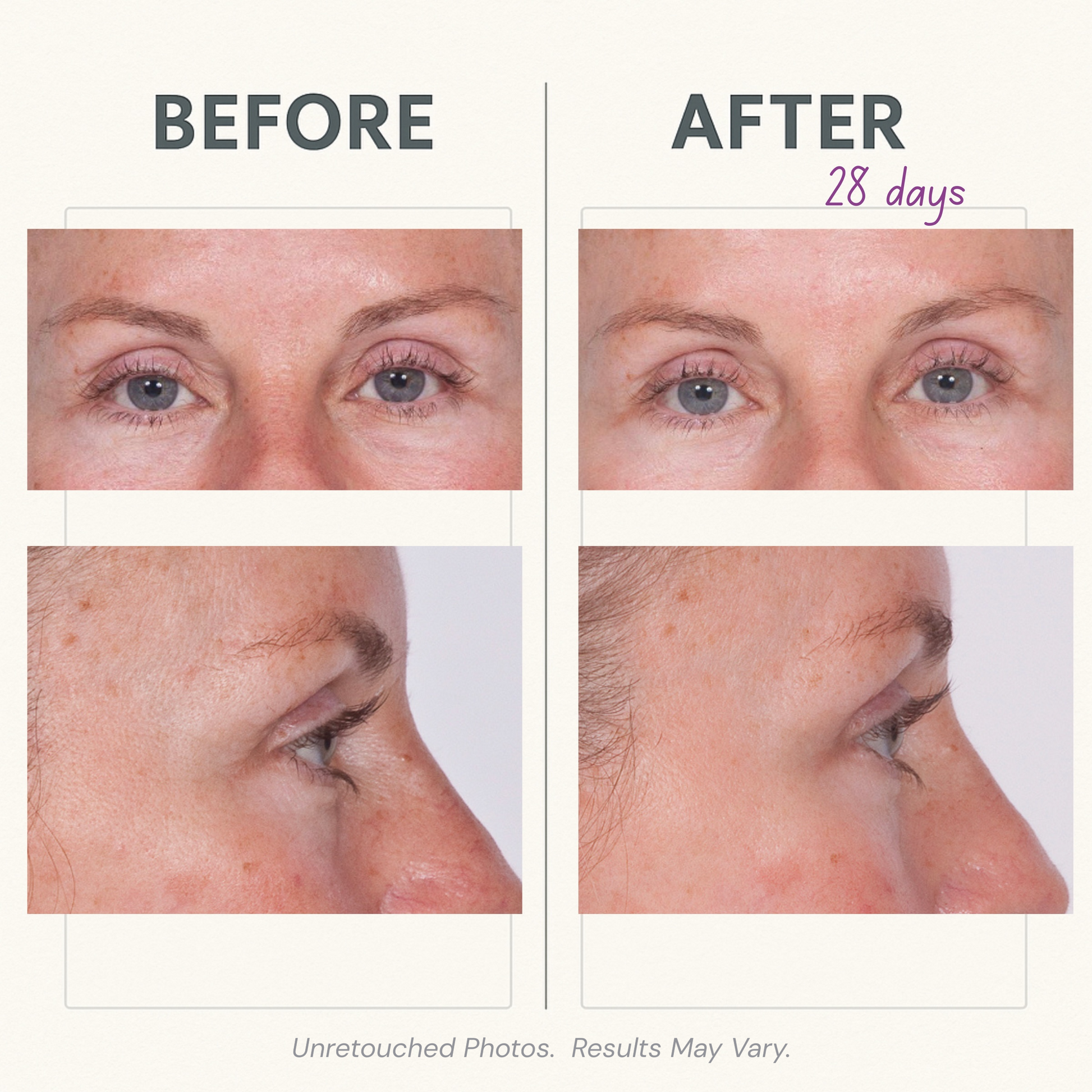 Serious Skincare Reverse Lift Firming Eye Cream with peptides and Argifirm Complex to visibly firm, smooth and reduce the look of crow’s feet, fine lines and wrinkles.