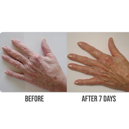 Rulinea_FX_Topical_Regenerating_Hand_Cream before and after 7 days
