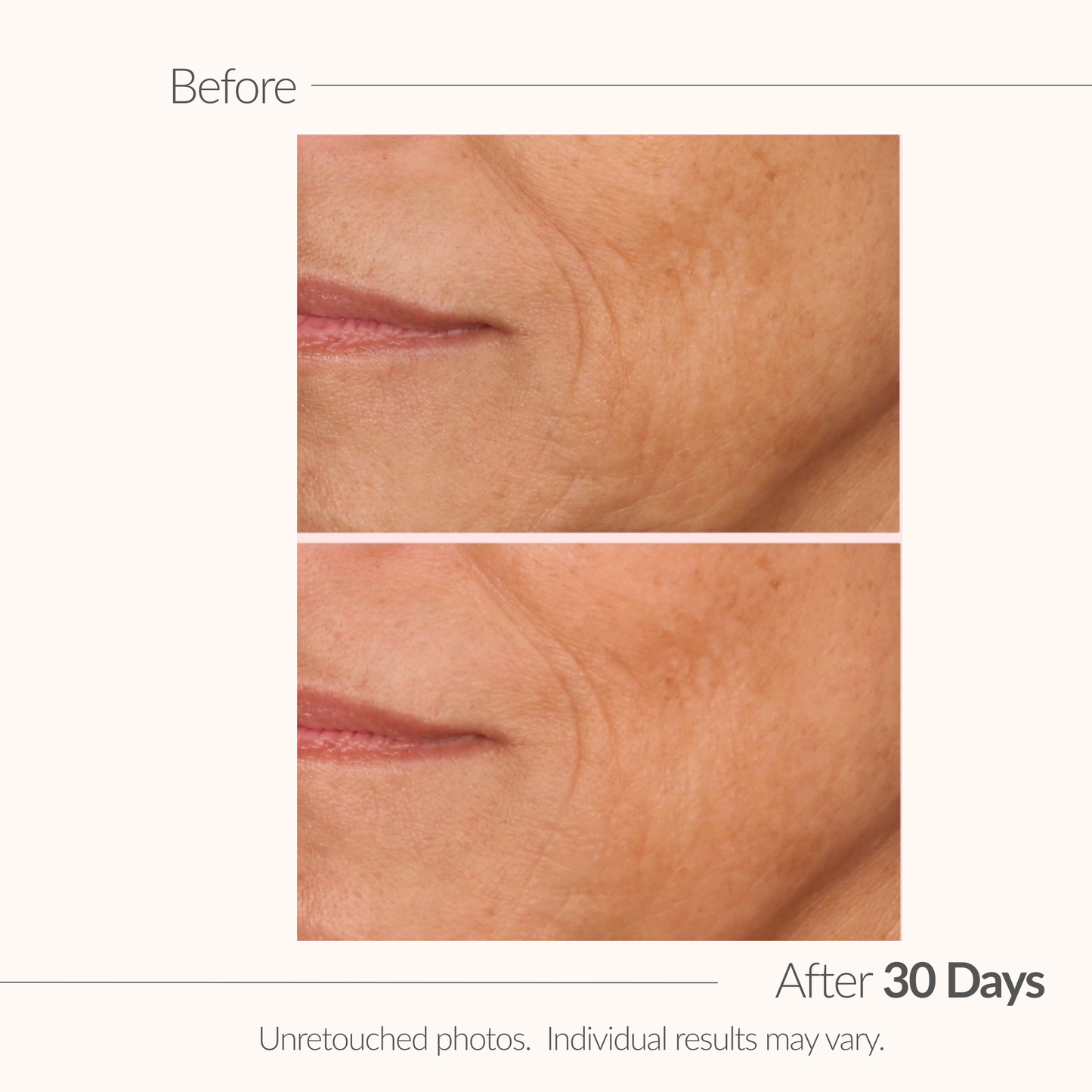 Before and after comparison of skin texture with a visible wrinkle, labeled 'After 30 Days'.