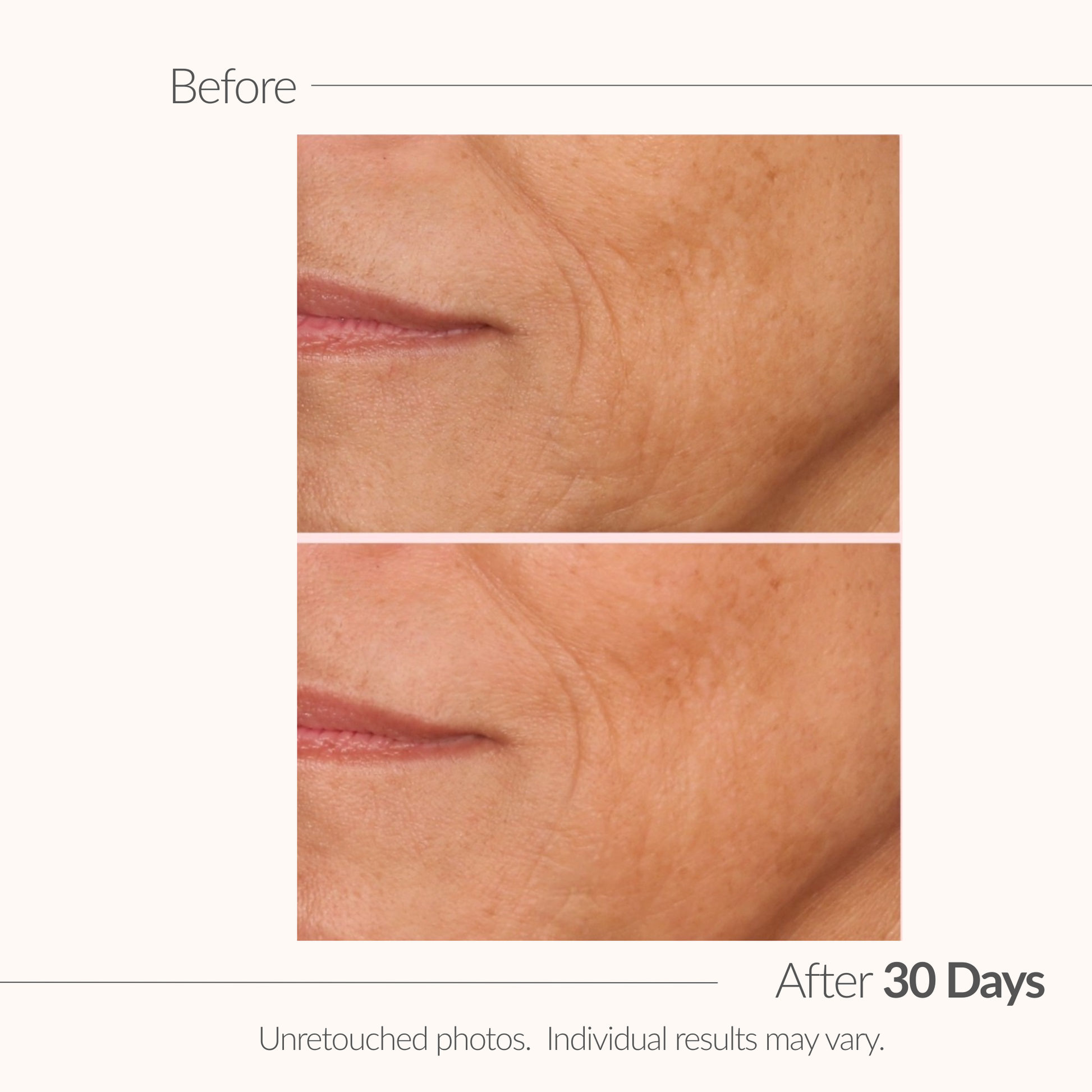 Before and after comparison of skin texture with a visible wrinkle, labeled 'After 30 Days'.