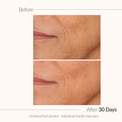 Before and after comparison of skin texture with a visible wrinkle, labeled 'After 30 Days'.
