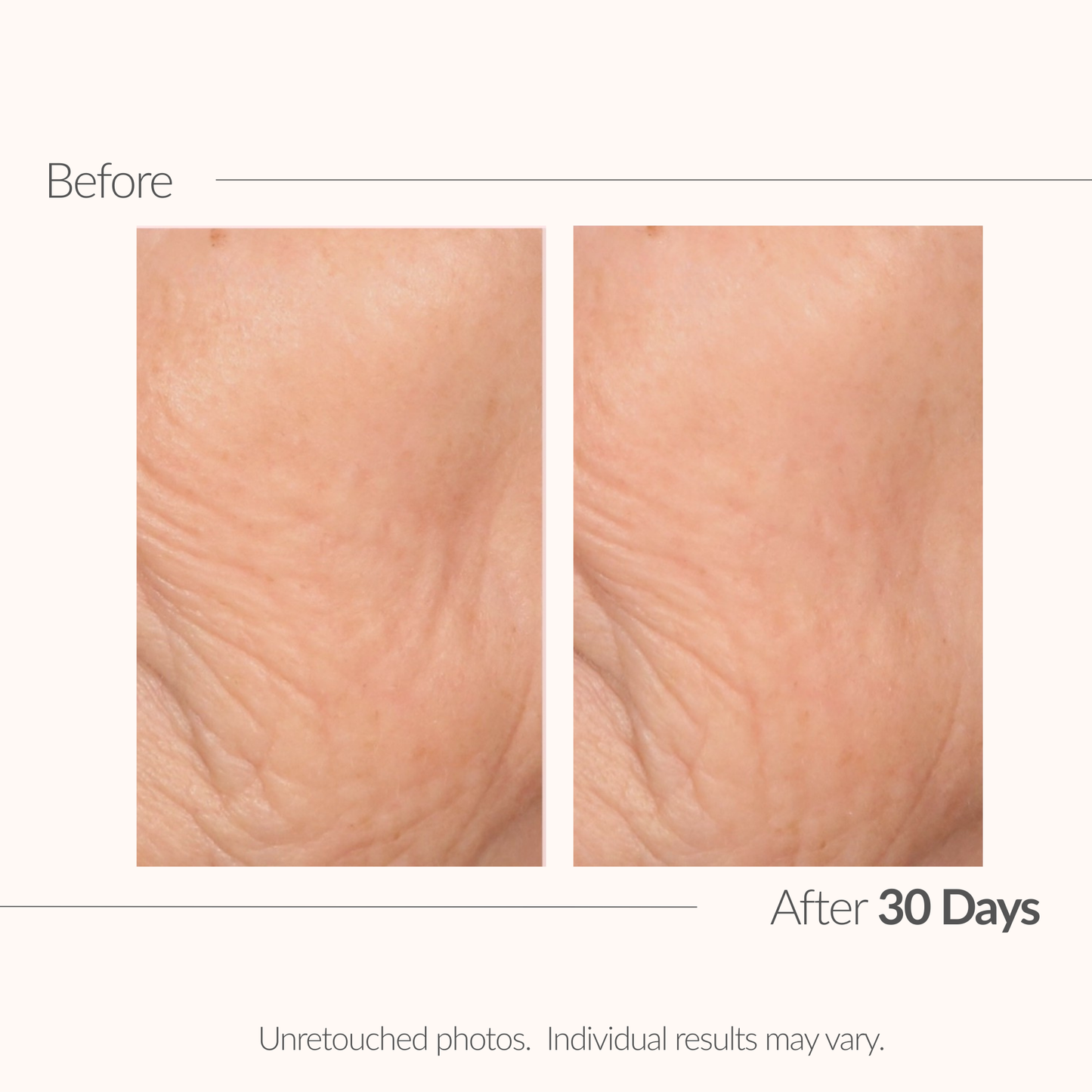 Before and after comparison of skin texture with text indicating a time frame.