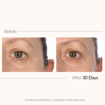 Before and after comparison of a person's eye with text indicating results after 30 days.