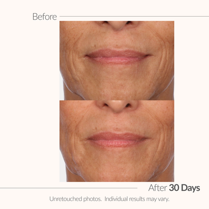 Serious C3 C-Extreme Results Duo