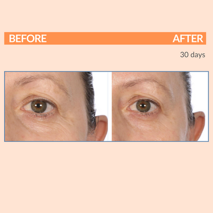 Serious C3 Before After Eye