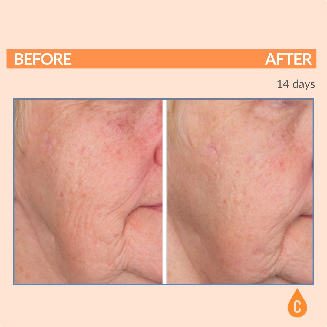 John's Personal Over 60 Regimen