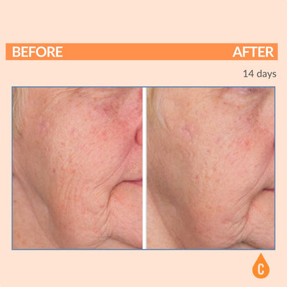 John's Personal Over 60 Regimen