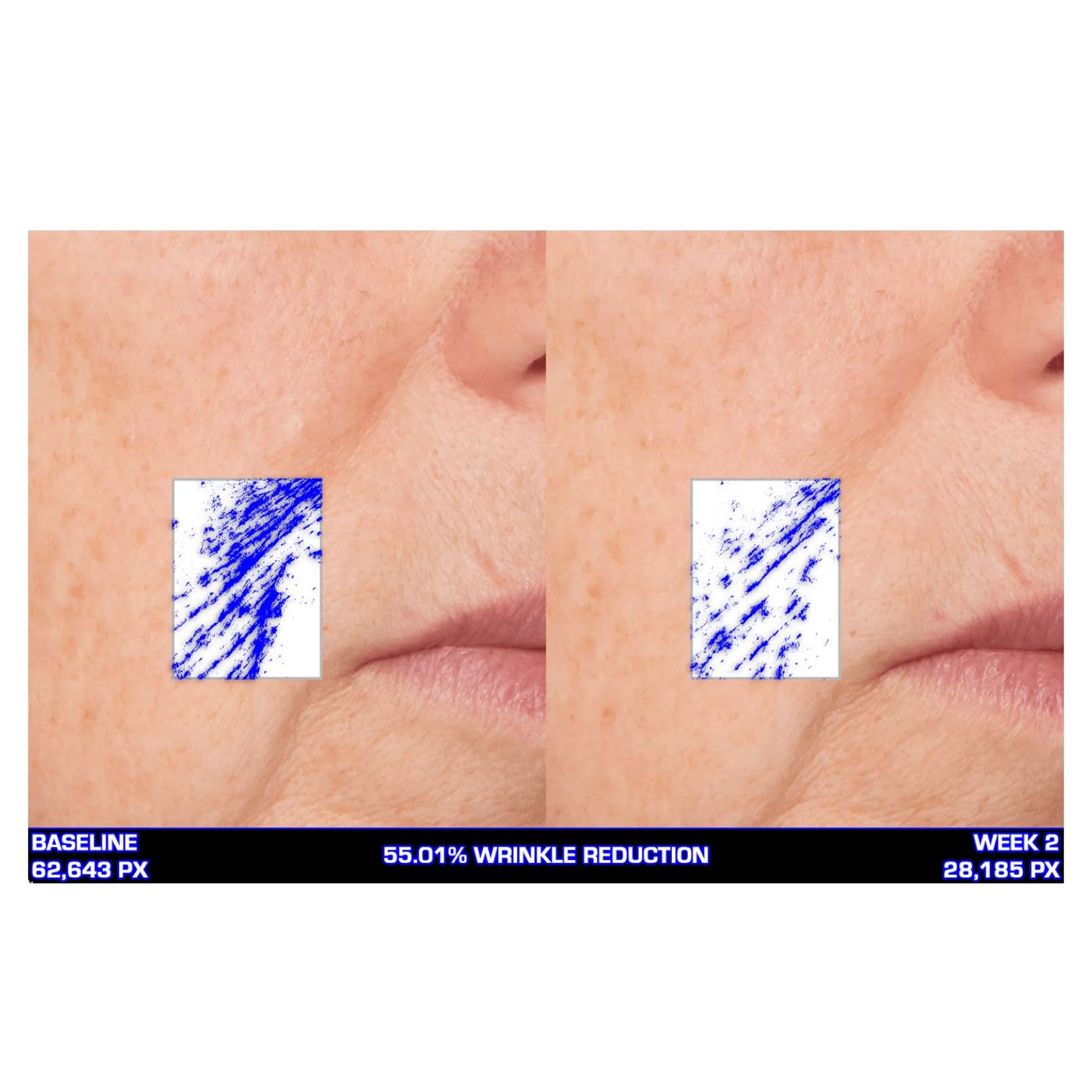 Serious Skincare Ultra Mare Serum hydrating anti-aging facial serum to smooth, nourish and improve the look of fine lines, wrinkles and aging skin.
