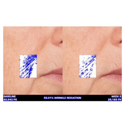 Serious Skincare Ultra Mare Serum hydrating anti-aging facial serum to smooth, nourish and improve the look of fine lines, wrinkles and aging skin.