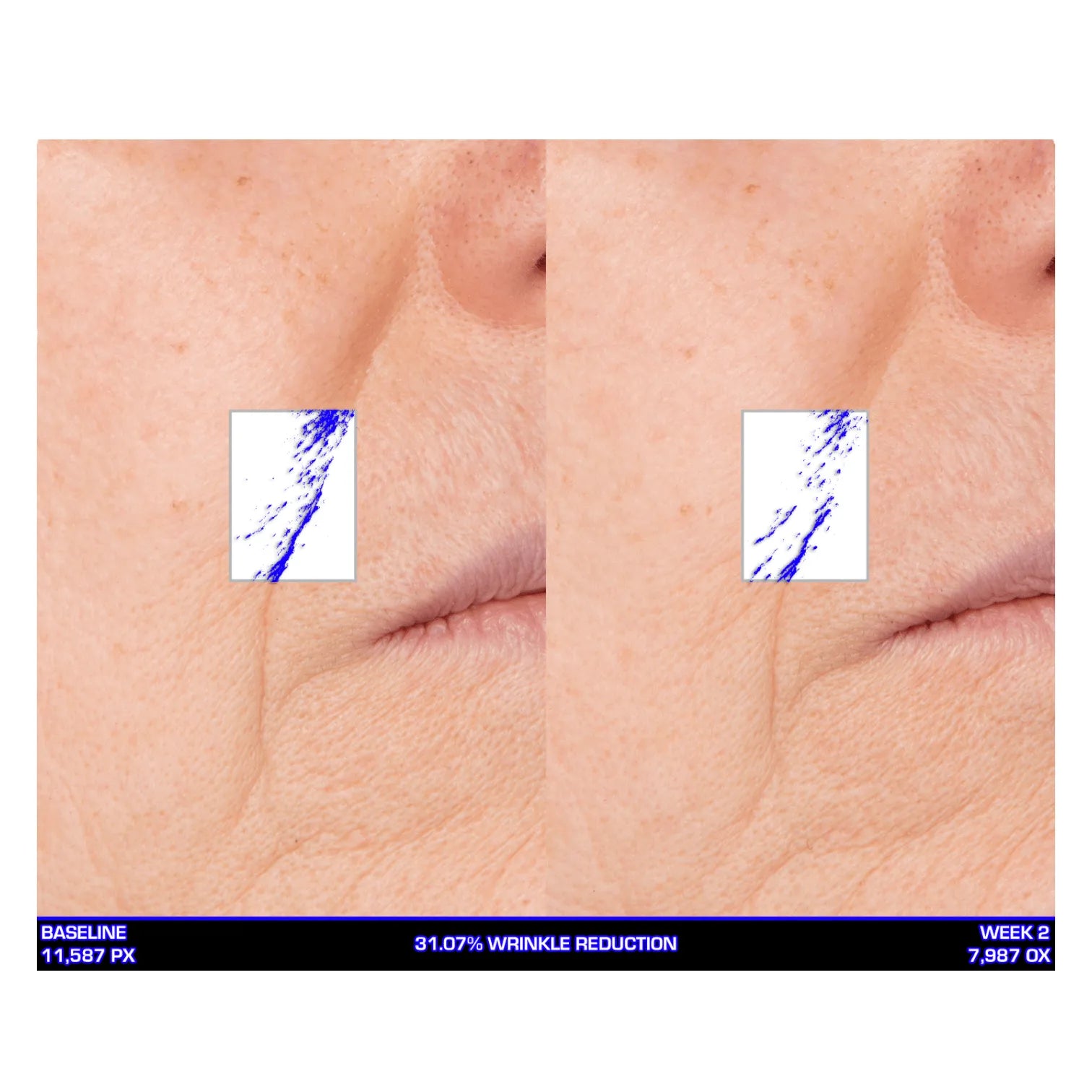 Serious Skincare Ultra Mare Serum hydrating anti-aging facial serum to smooth, nourish and improve the look of fine lines, wrinkles and aging skin.
