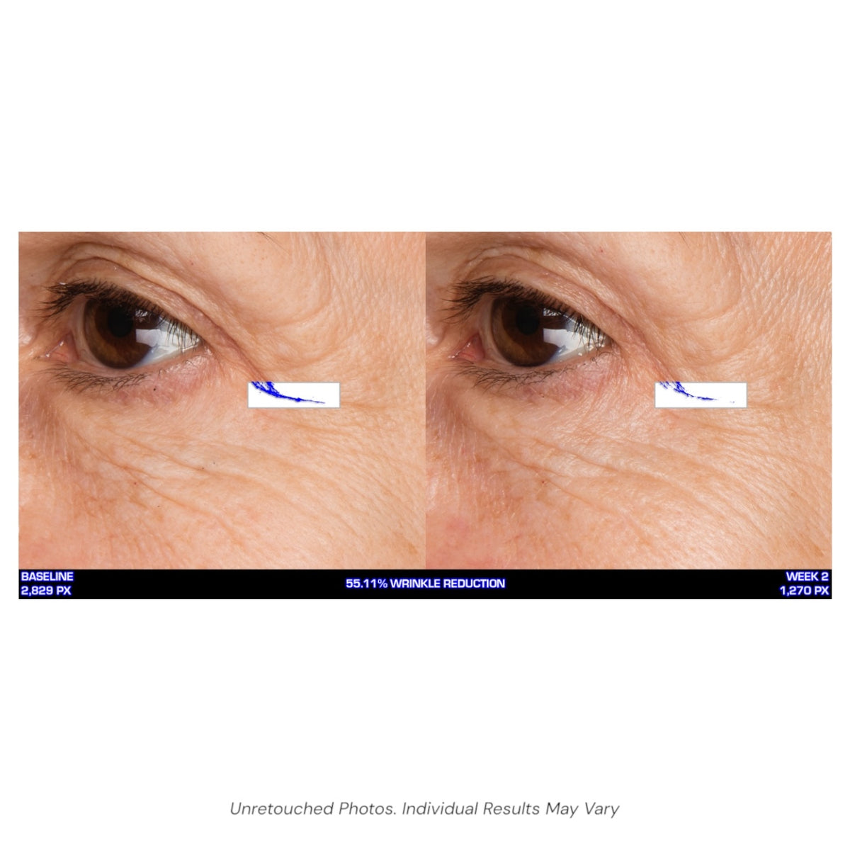 Serious Skincare Ultra Mare Serum hydrating anti-aging facial serum to smooth, nourish and improve the look of fine lines, wrinkles and aging skin.