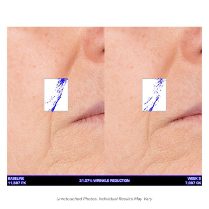 Serious Skincare Ultra Mare Serum hydrating anti-aging facial serum to smooth, nourish and improve the look of fine lines, wrinkles and aging skin.