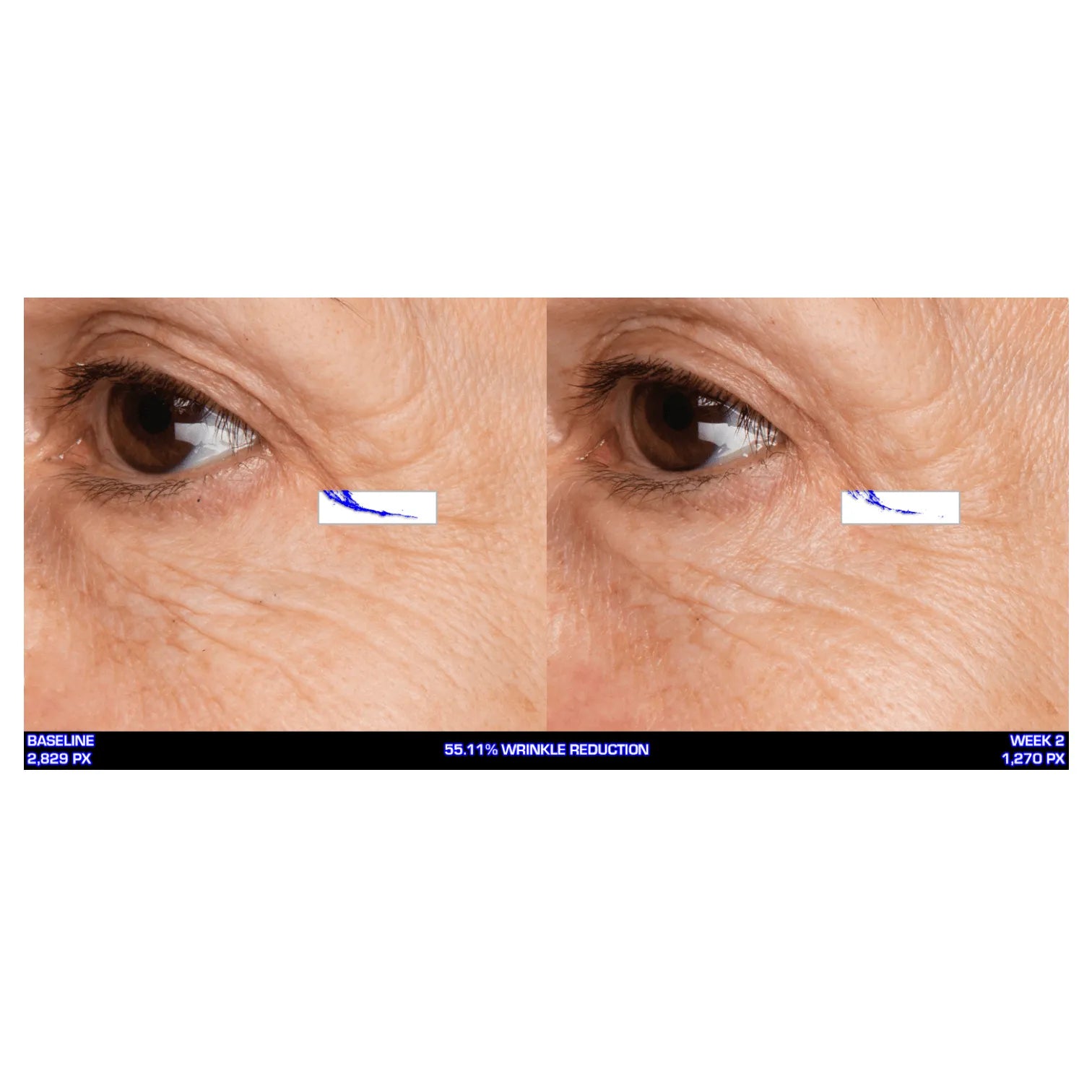 Serious Skincare Ultra Mare Serum hydrating anti-aging facial serum to smooth, nourish and improve the look of fine lines, wrinkles and aging skin.