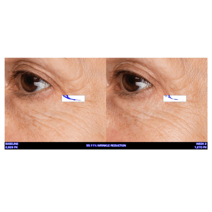 Serious Skincare Ultra Mare Serum hydrating anti-aging facial serum to smooth, nourish and improve the look of fine lines, wrinkles and aging skin.