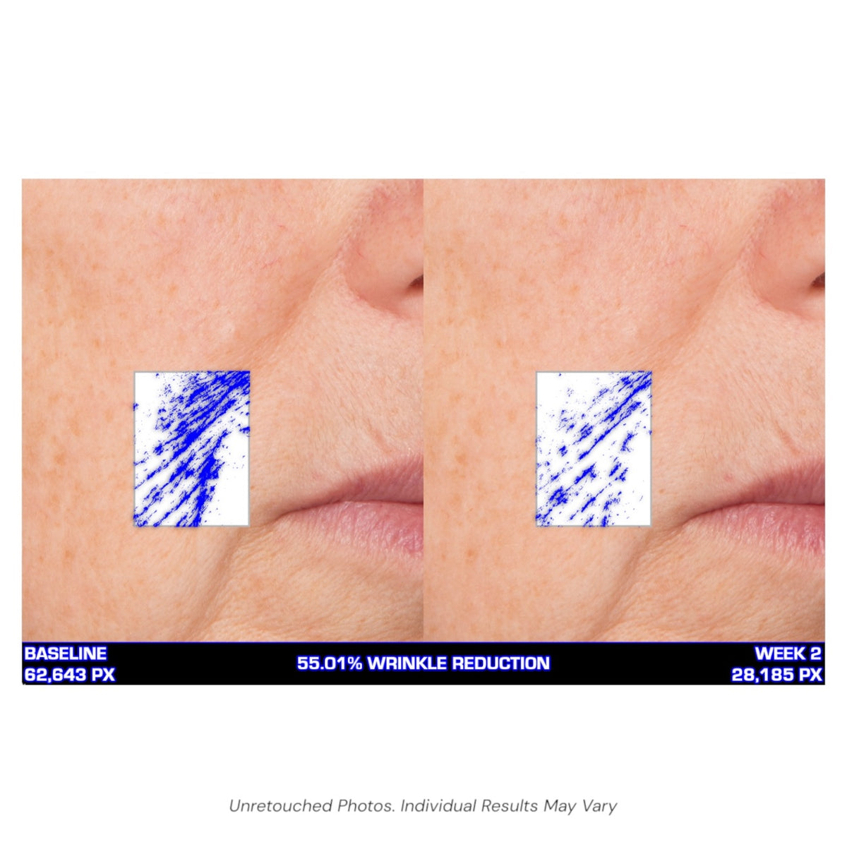 Serious Skincare Ultra Mare Serum hydrating anti-aging facial serum to smooth, nourish and improve the look of fine lines, wrinkles and aging skin.